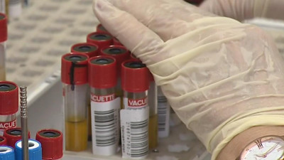 Комздрав рассказал о сроках тестирования и ретестирования на COVID-19