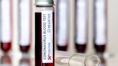 Четыре футболиста «Локомотива» заразились коронавирусом