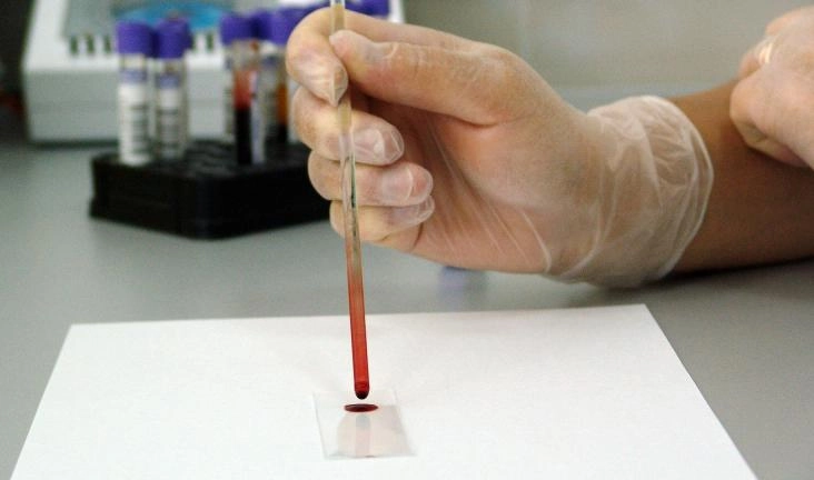 Петербуржцы смогут бесплатно пройти тестирование на ВИЧ в канун 8 марта - tvspb.ru