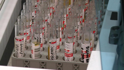 Из-за коронавируса в России может вырасти спрос на медицинские страховки