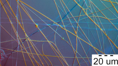 Ученые ИТМО создали нановолокна, заживляющие раны