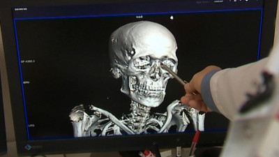 Что узнали ученые, проводившие компьютерную томографию эрмитажной мумии