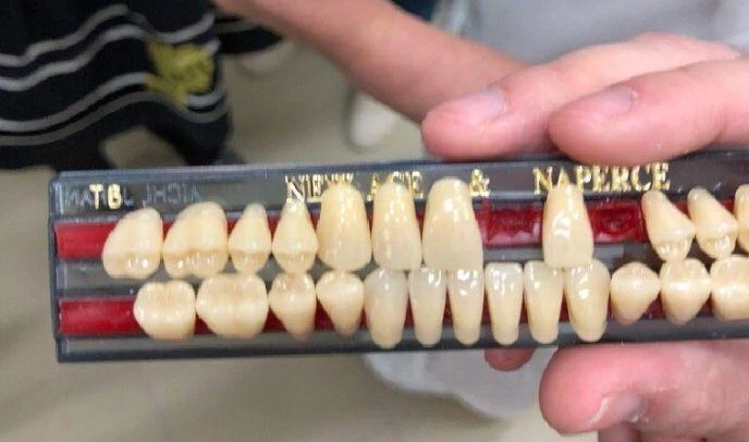 Петербургские студенты предлагают печатать зубные коронки из жидкой керамики - tvspb.ru