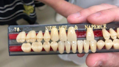 Петербургские студенты предлагают печатать зубные коронки из жидкой керамики