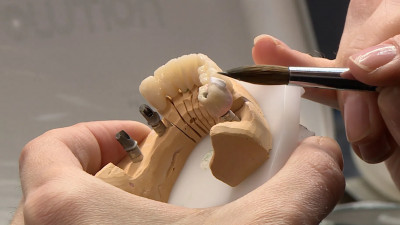 Цифровая точность: Как в Петербурге производят зубные протезы