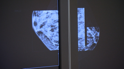 В Госпитале для ветеранов войн открыли маммографический кабинет