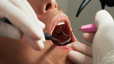 Протезирование при полном отсутствии зубов: варианты и сложности