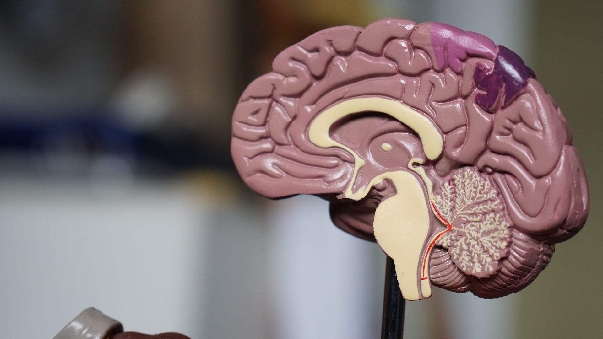 Аневризма сосудов головного мозга: симптомы и риски для жизни | Телеканал  Санкт-Петербург