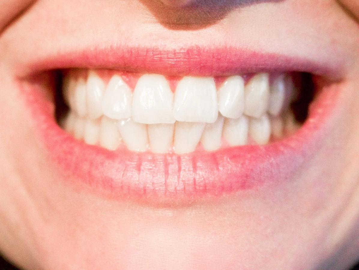 Стоматолог объяснила, как стресс влияет на здоровье зубов - tvspb.ru