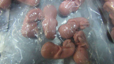 Женщина пыталась вывести из Эстонии 200 моделей эмбриона человека