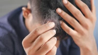 Врач Мызникова перечислила самые распространенные причины выпадения волос
