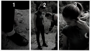 Первая помощь: что делать, когда обнаружили присосавшегося к вам клеща