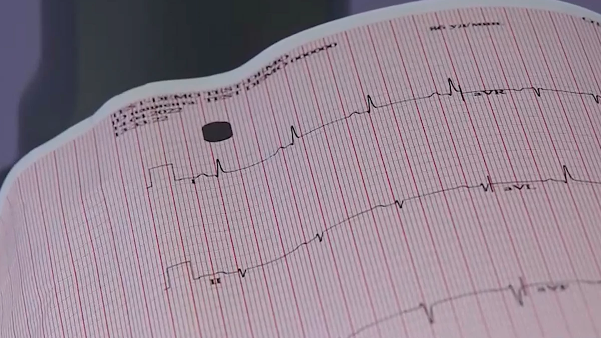 В России выросло число высокотехнологичных операций на сердце - tvspb.ru