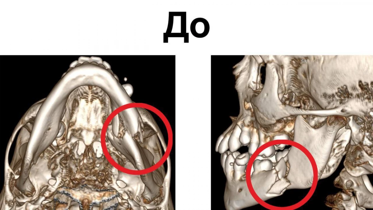Ребенка с раздробленной после ДТП челюстью спасли в медцентре Рошаля - tvspb.ru