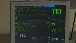 Малоинвазивные операции при тромбоэмболии легочной артерии