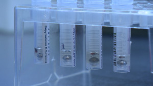 Первая помощь: что делать, когда обнаружили присосавшегося к вам клеща