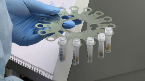 Лабораторные исследования клещей в Клинической инфекционной больнице им. С.П. Боткина