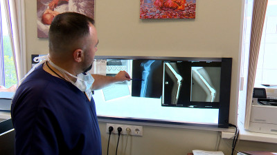 В Петербурге впервые установили отечественный растущий протез коленного сустава ребенку