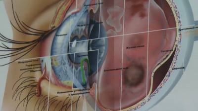 Как предотвратить близорукость и что делать, если она уже возникла