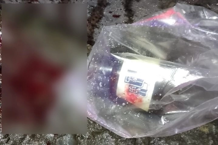 Конфликт с «розочкой» в шее: драка возле ночного клуба в Петербурге закончилась задержанием и госпитализацией - tvspb.ru