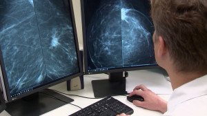 Диагностика и лечение рака молочной железы в онкоцентре им. Напалкова