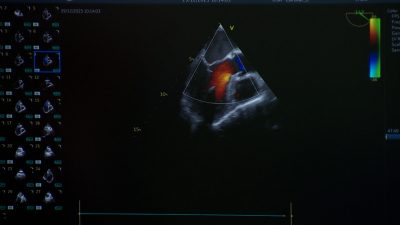 Врачи Госпиталя для ветеранов войн рассказали, как сохранить здоровье сердца