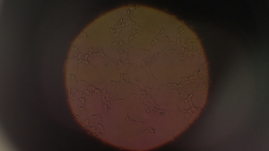 Лазер против рака